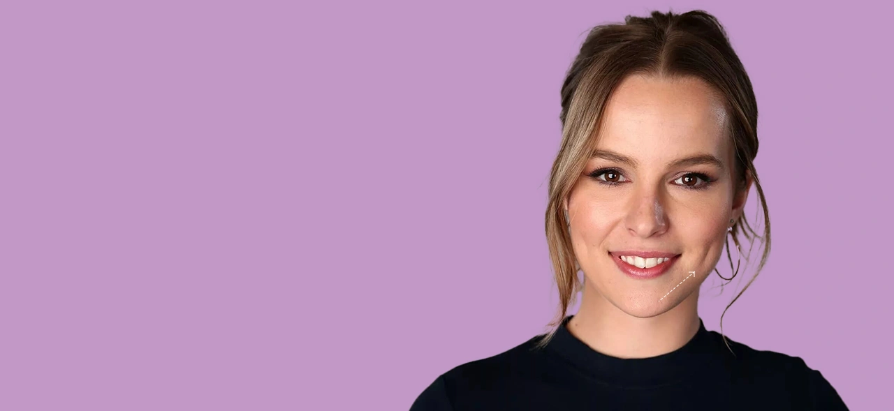 Dimple creation surgery in Gurgaon