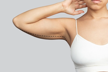 Arm Lift Surgeryy