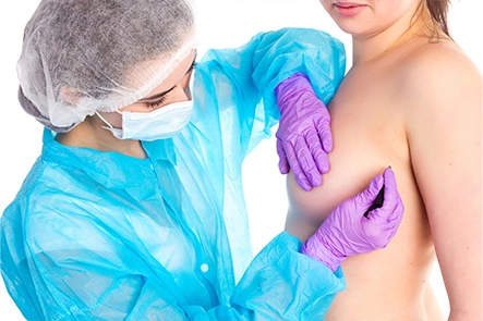 Procedure of Breast Removal Surgery