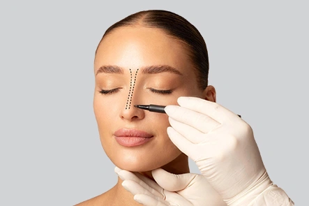 Procedure of Rhinoplasty  Surgery