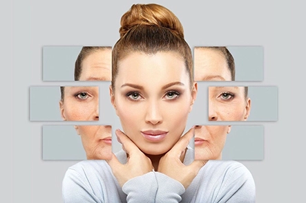 Benefits of Botox treatment