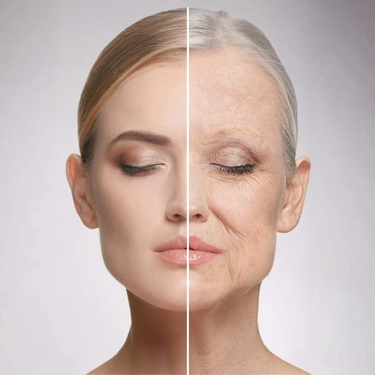 Benefits of Facelift Surgery