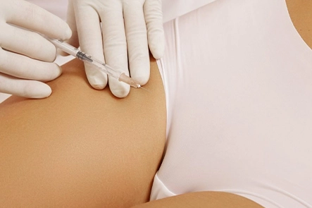 Procedure of  G-Shot Treatment