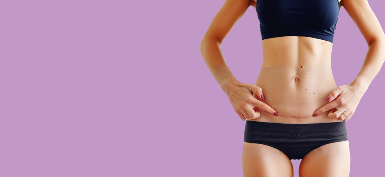 Scar Revision Surgery