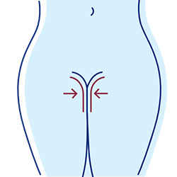 Vaginal Tightening Treatment