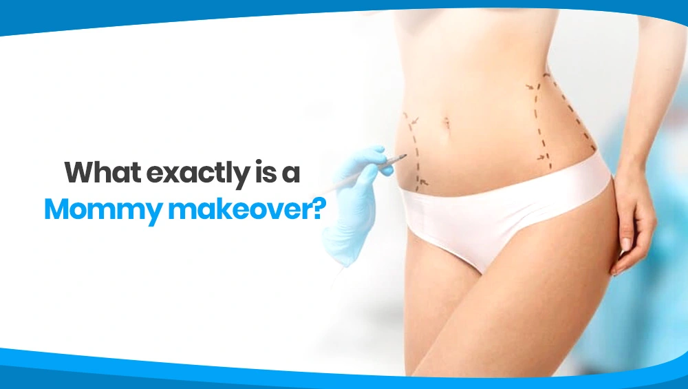 Mommy makeover : All You Need to Know