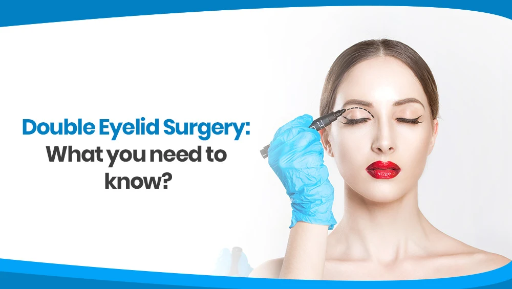 Double Eyelid Surgery