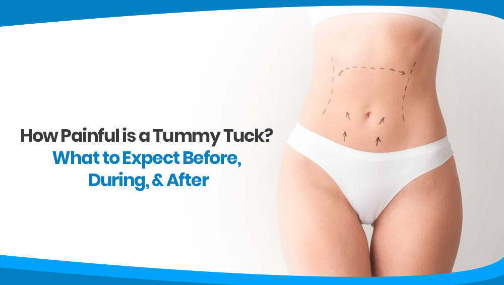 How Painful Is a Tummy Tuck?