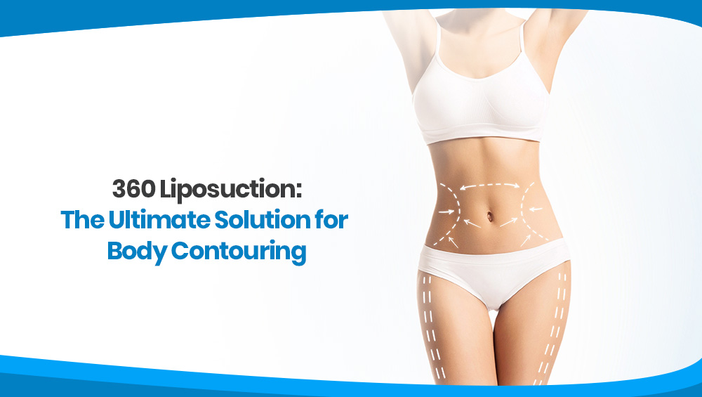 What is a 360 liposuction?