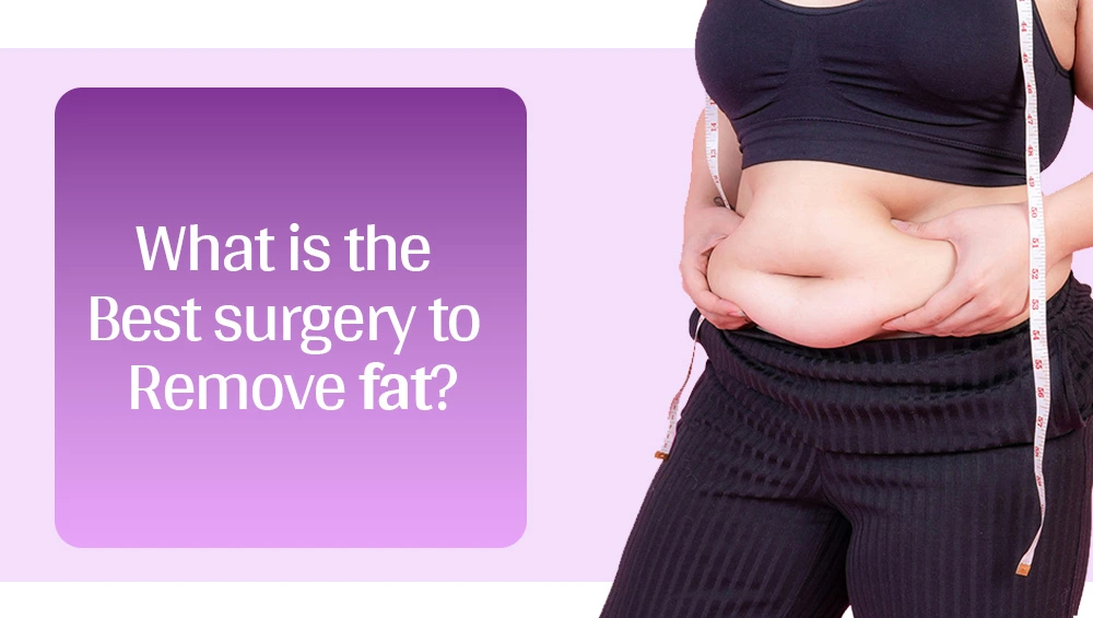 What Is The Best Surgery To Remove Fat? 