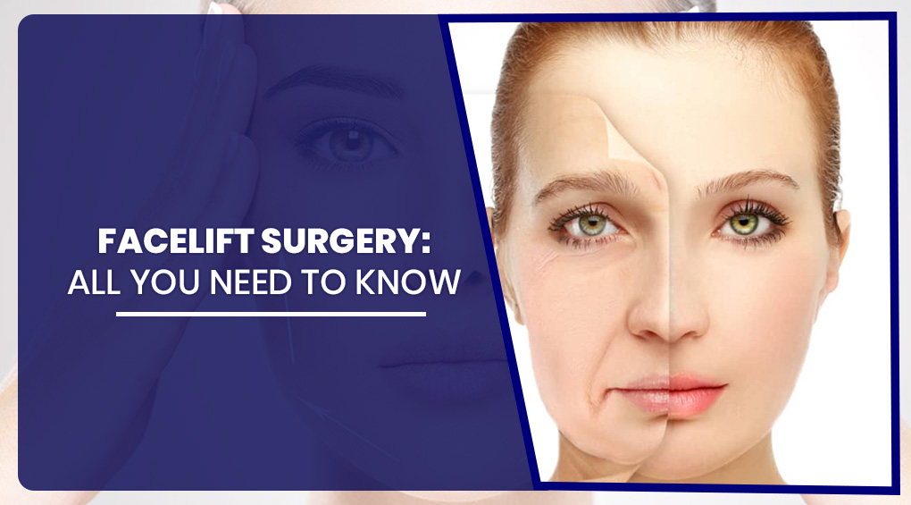 Facelift Surgery: All You Need to Know