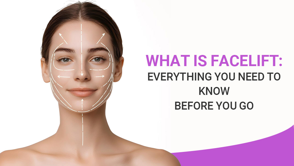 What is Facelift: Everything You Need to Know Before You Go