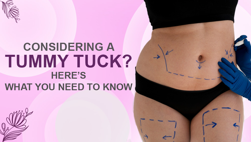 Considering a Tummy Tuck? Here’s What You Need to Know