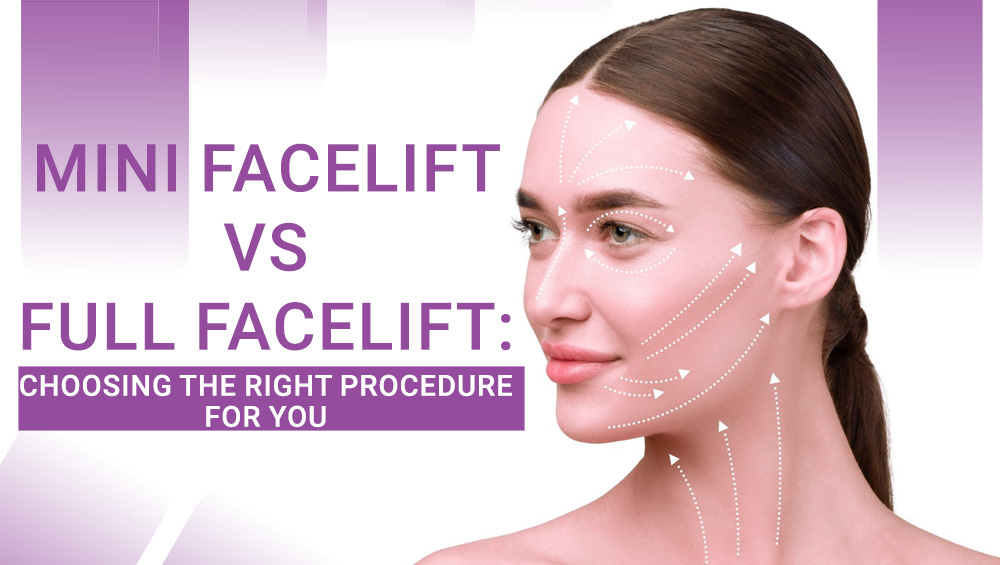 Mini Facelift vs Full Facelift: Choosing the Right Procedure for You