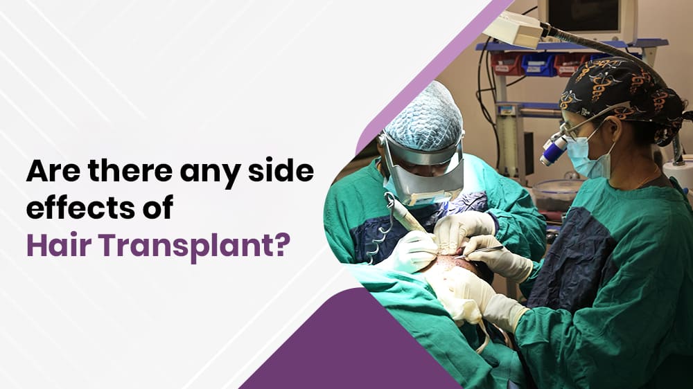 Are There Any Side Effects Of Hair Transplant?