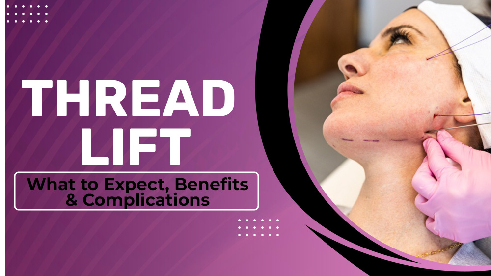 Thread Lift: What to Expect, Benefits & Complications