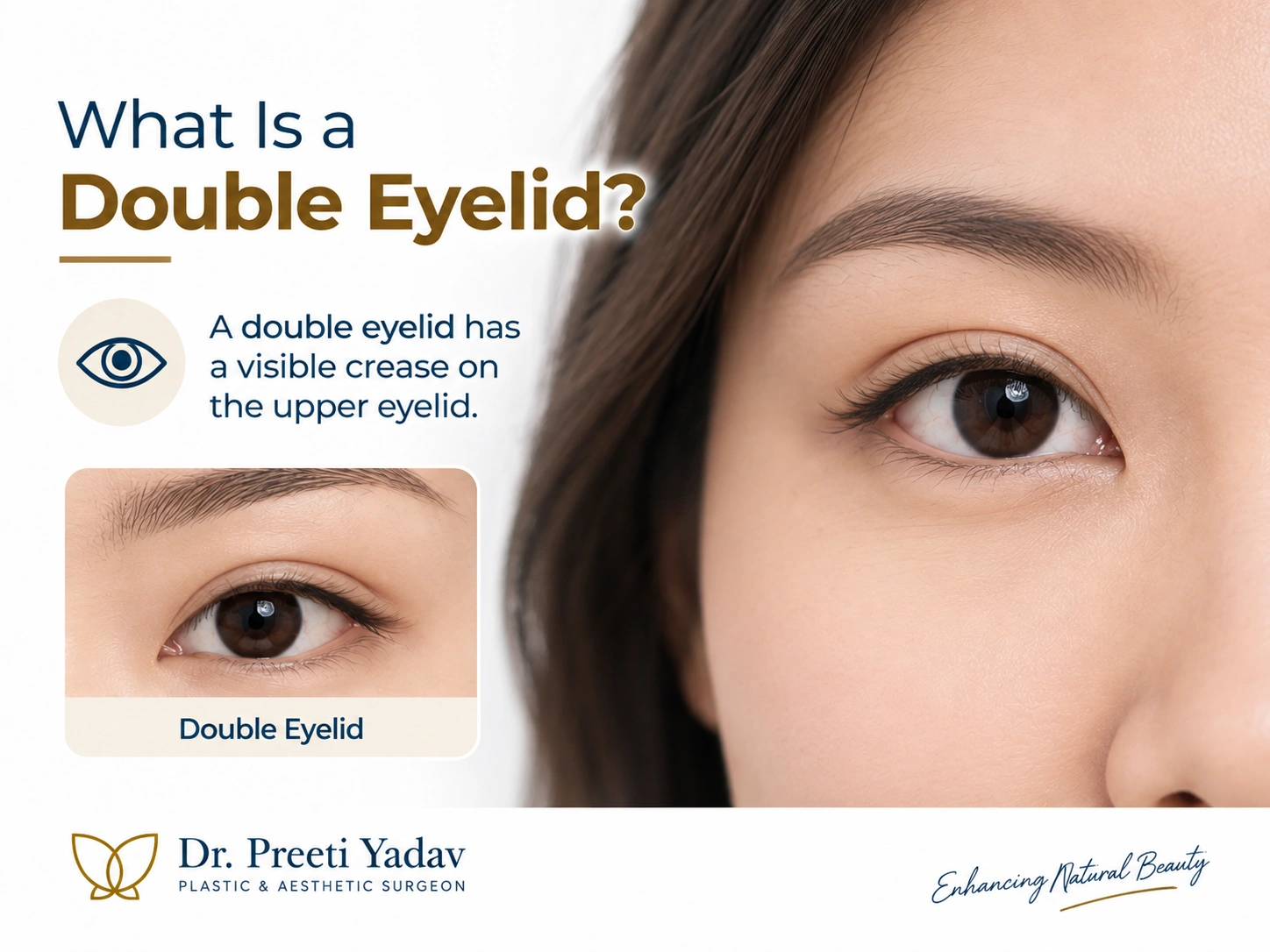 Monolid or Single Eyelid