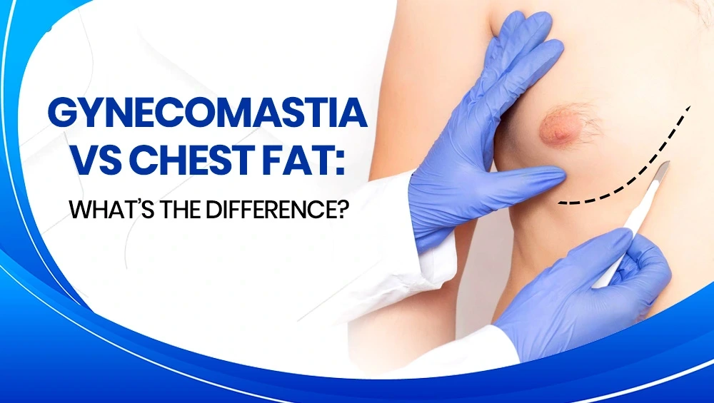 Gynecomastia vs Chest Fat: What’s the Difference?