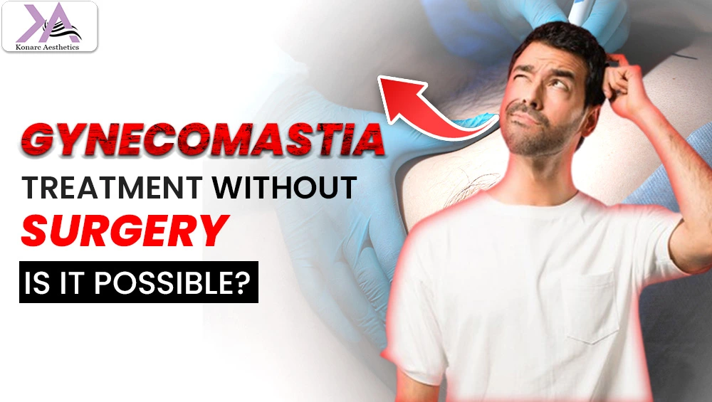 Gynecomastia Treatment Without Surgery: Is IT Possible?