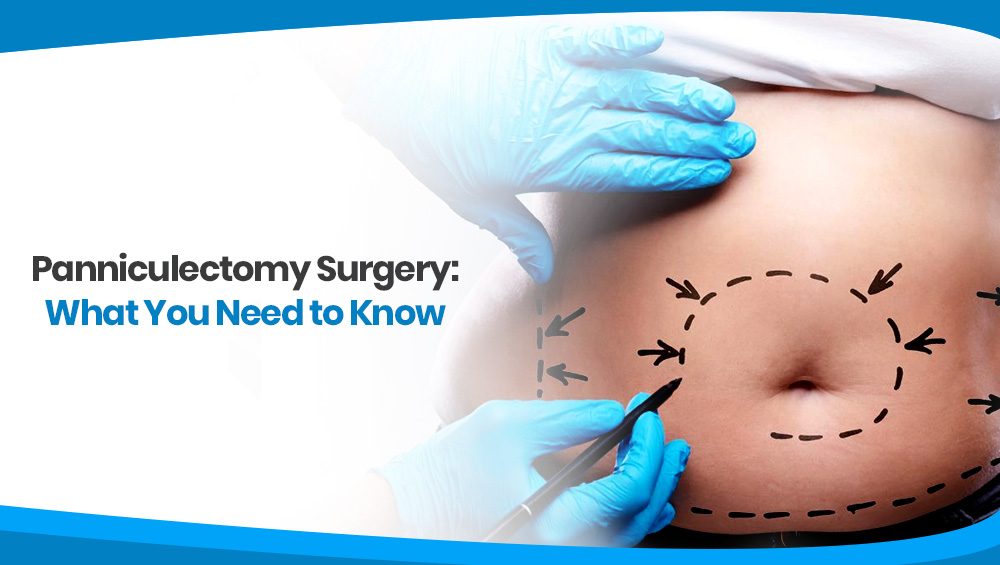 Panniculectomy Surgery