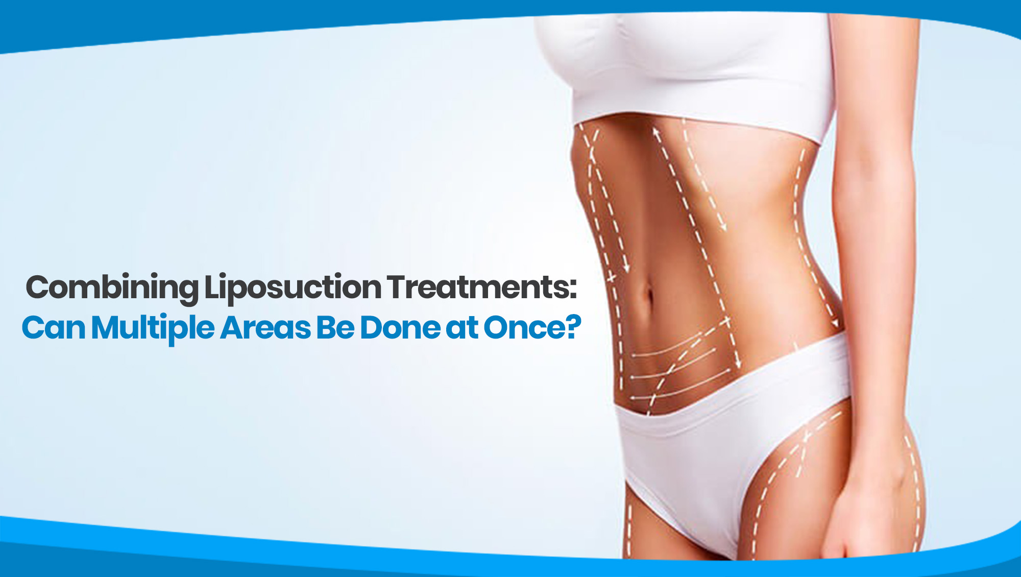 Combining Liposuction Treatments