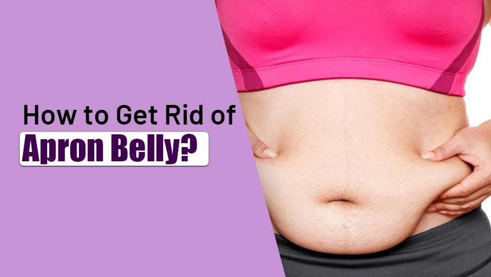 How to Get Rid of Apron Belly?