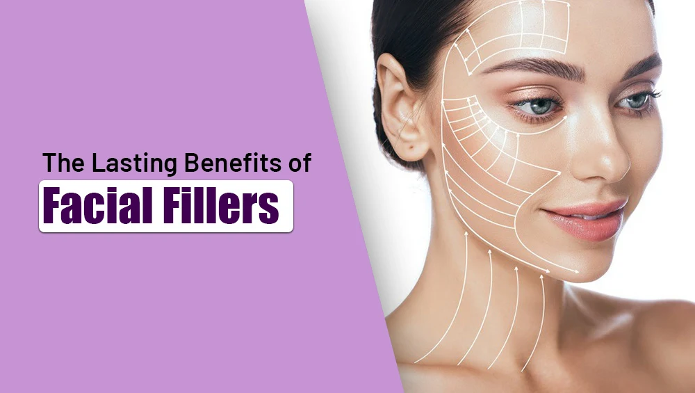 The Lasting Benefits of Facial Fillers