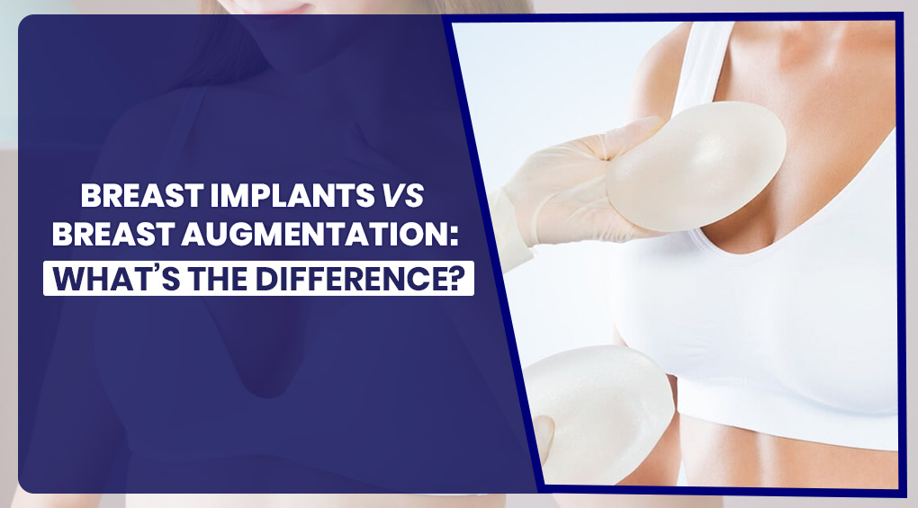 Breast Implants vs Breast Augmentation: What’s the Difference?