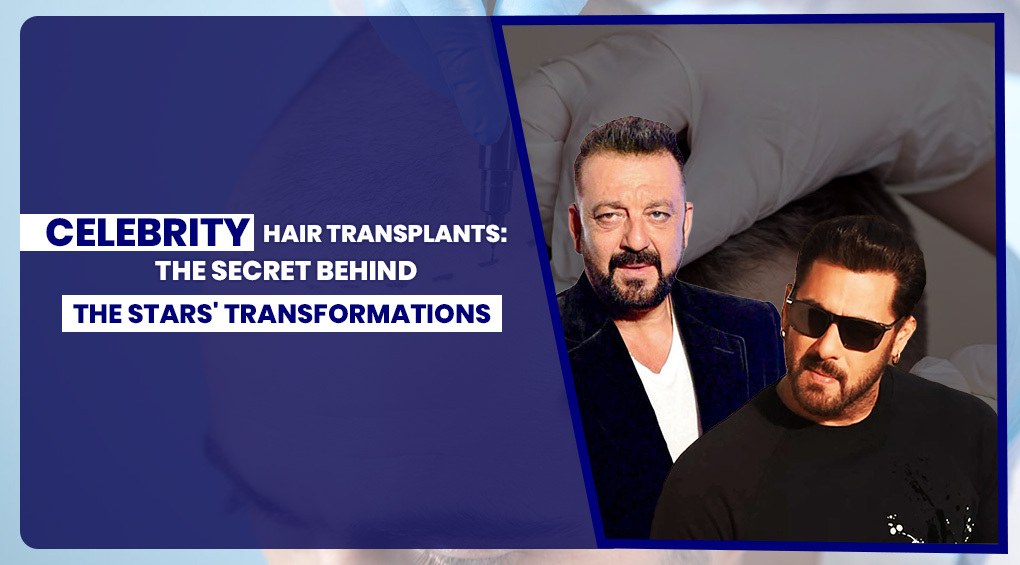 Celebrity Hair Transplants: The Secret Behind the Stars' Transformations