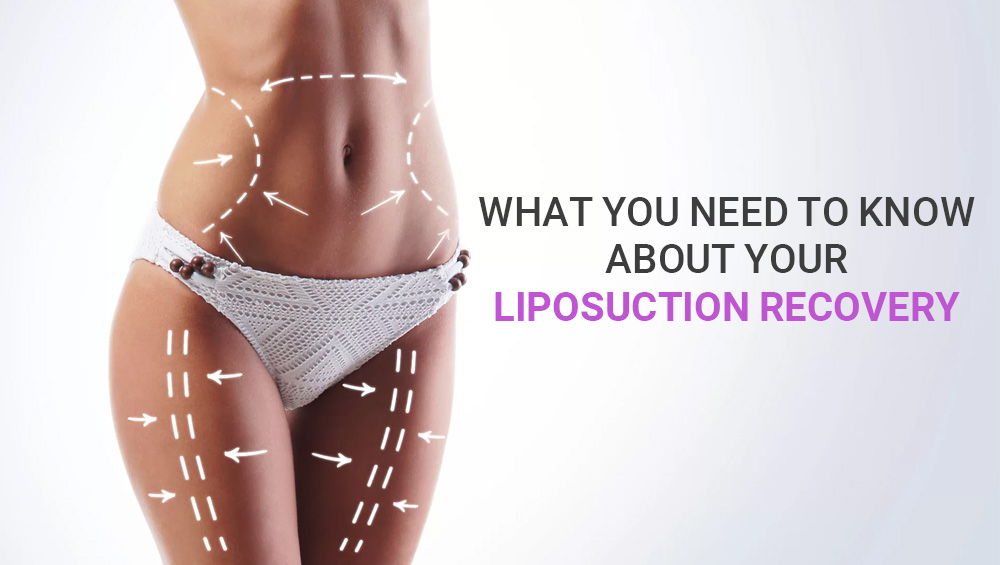 What You Need to Know About Your Liposuction Recovery?