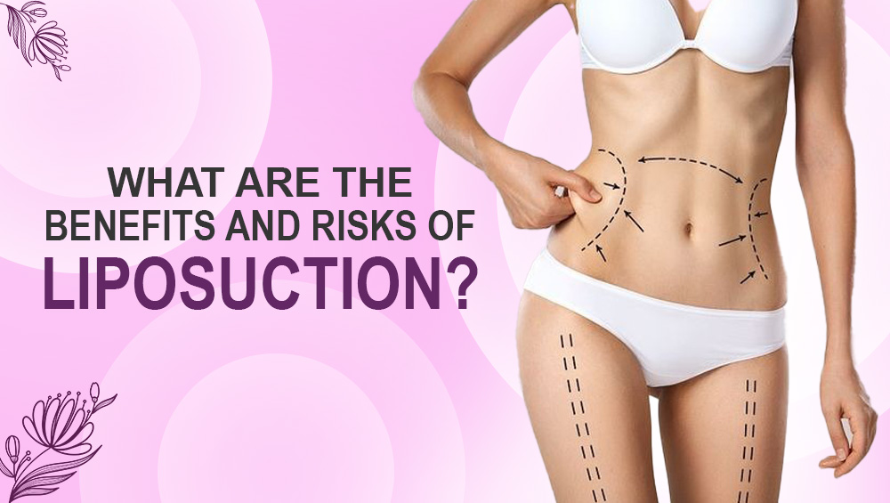 What are the benefits and risks of liposuction?