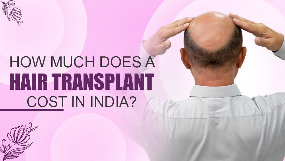 How Much Does A Hair Transplant Cost in India?