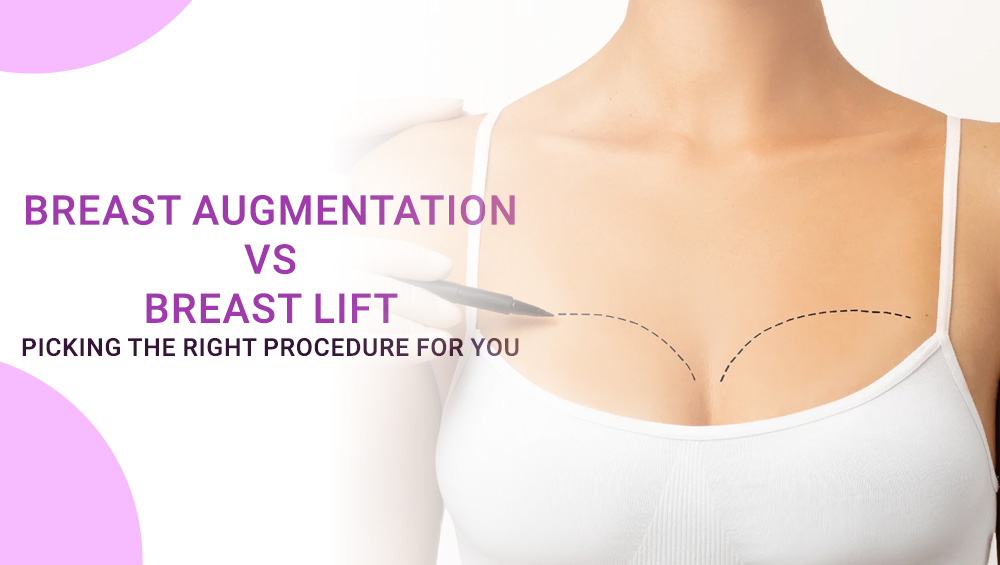 Breast Augmentation vs Breast Lift – Picking the Right Procedure for You