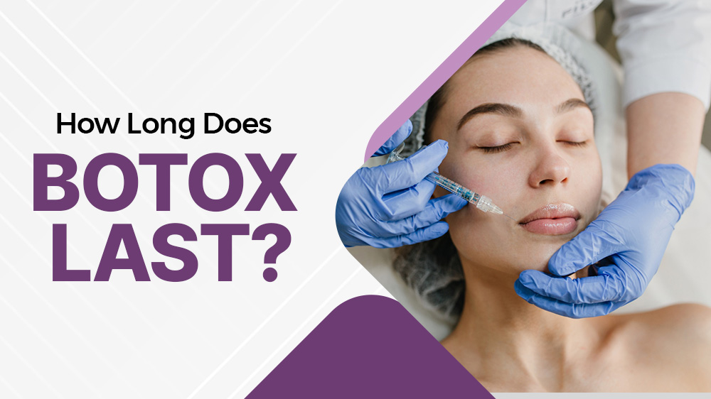 How Long Does Botox Last?