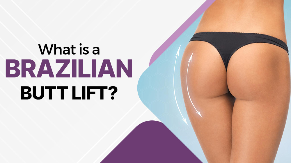 What Is a Brazilian Butt Lift?