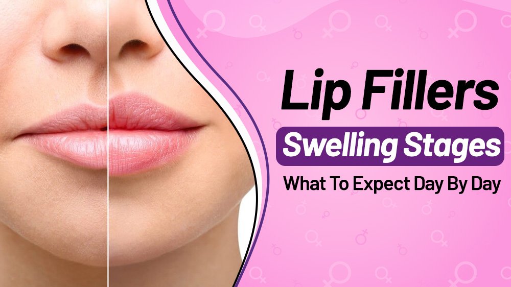 Lip Filler Swelling Stages: What To Expect Day By Day