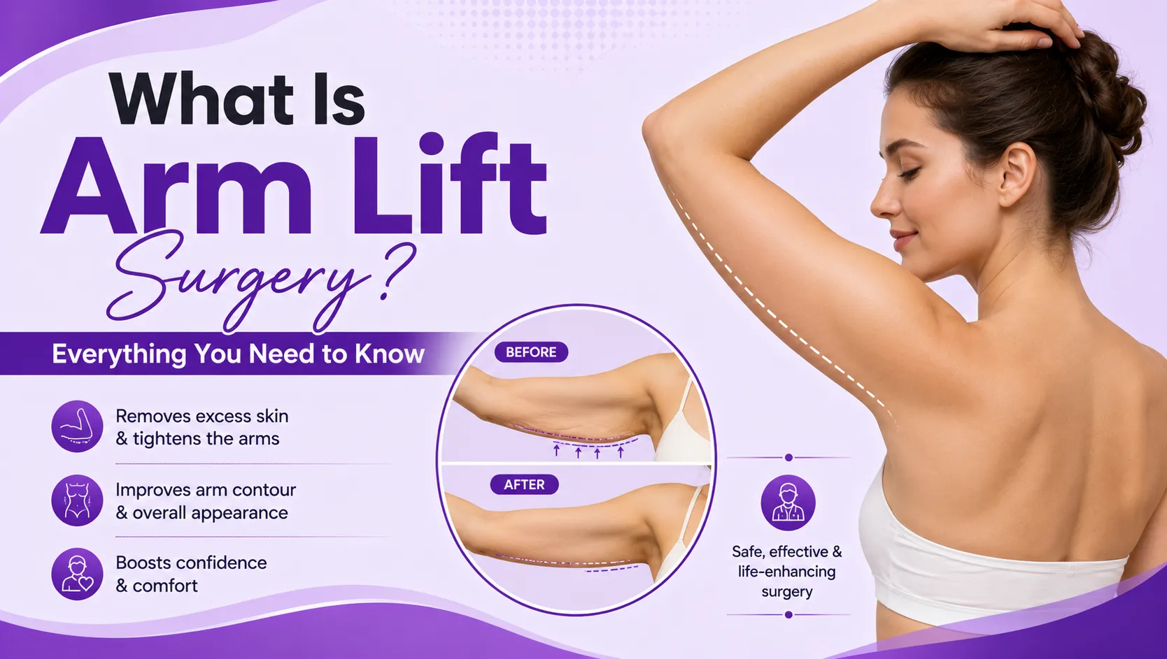 What Is Arm Lift Surgery? Everything You Need to Know