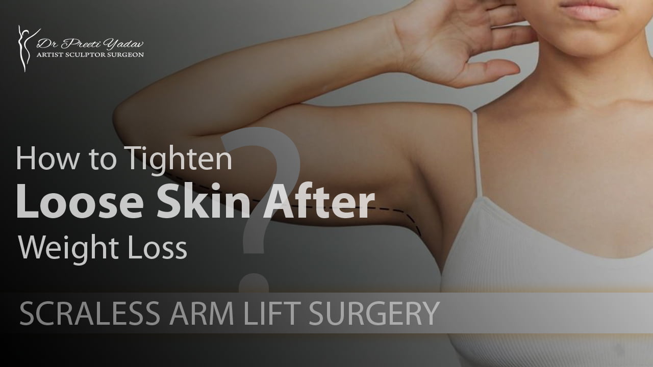 Arm Lift Surgery in Gurgaon