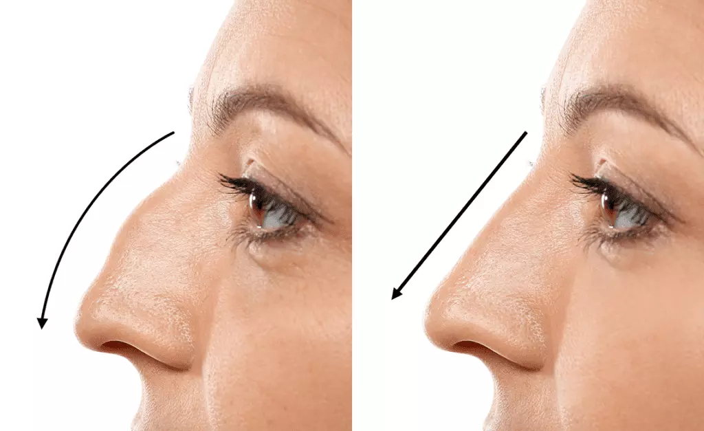How much does rhinoplasty cost in India?