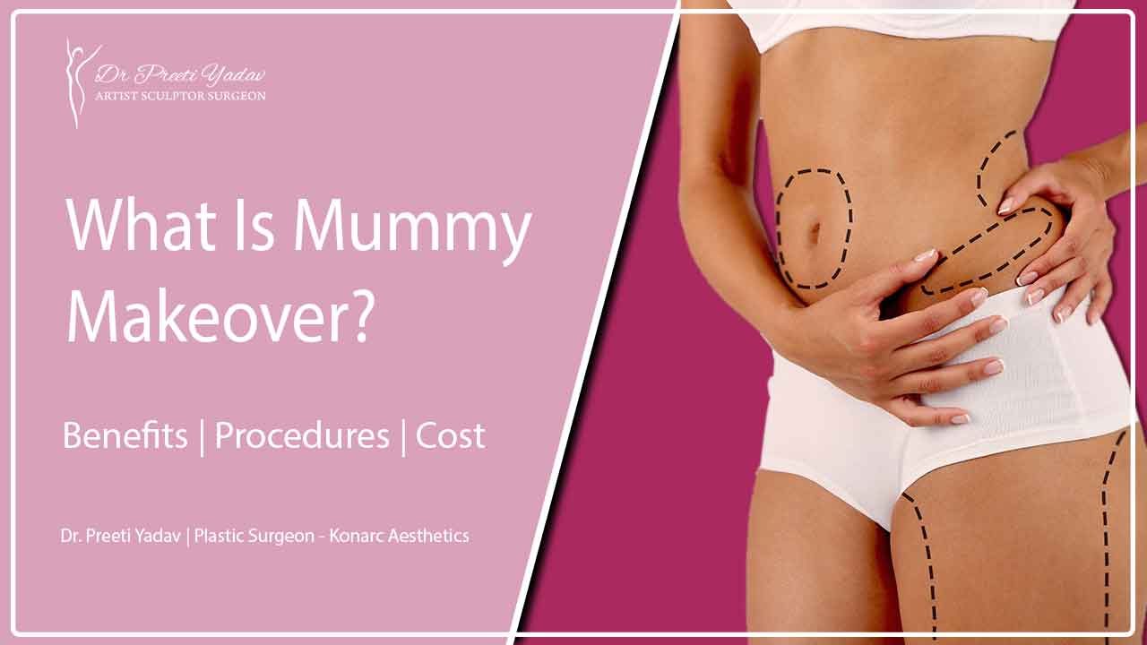 What Is Mummy Makeover?