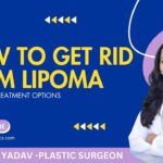 Lipoma Surgeon In Gurgaon