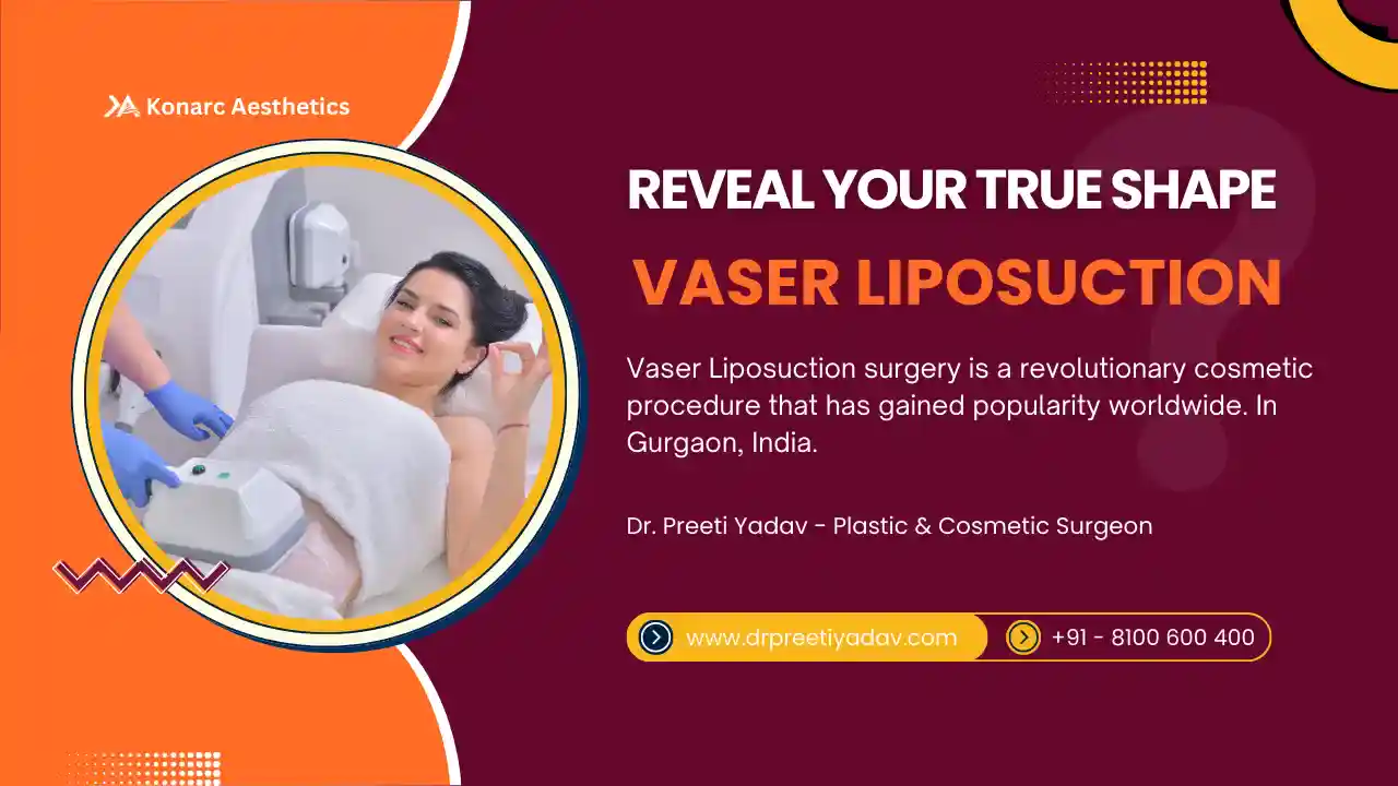 Vaser Liposuction Surgery in Gurgaon