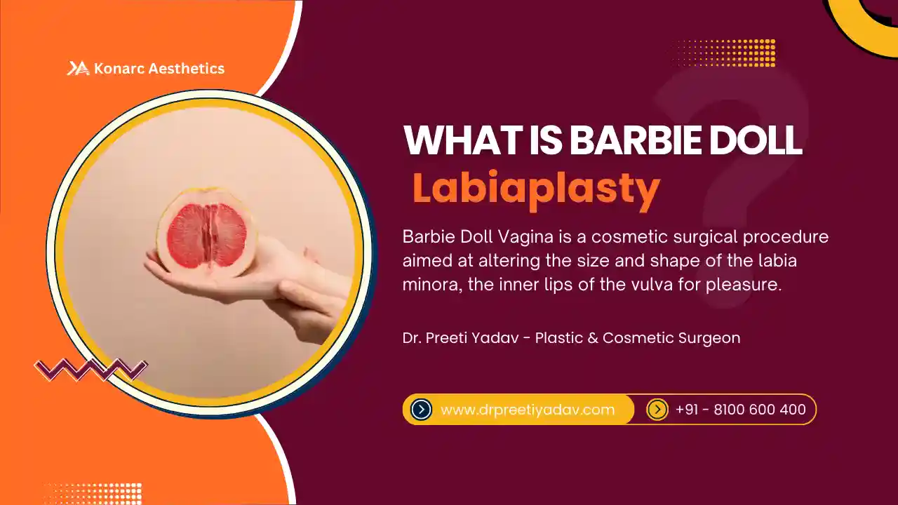 What is Barbie Doll Vagina